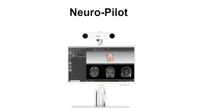 Hệ thống Robot Kích thích từ xuyên sọ (Robot TMS) - Ảnh 3