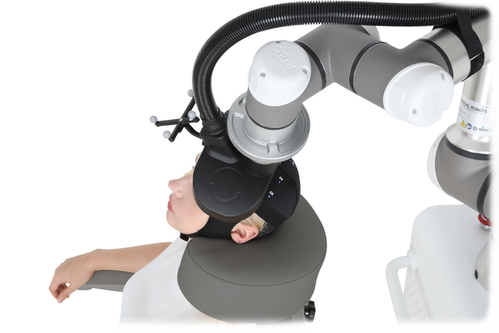 Hệ thống Robot Kích thích từ xuyên sọ (Robot TMS) - Ảnh 2
